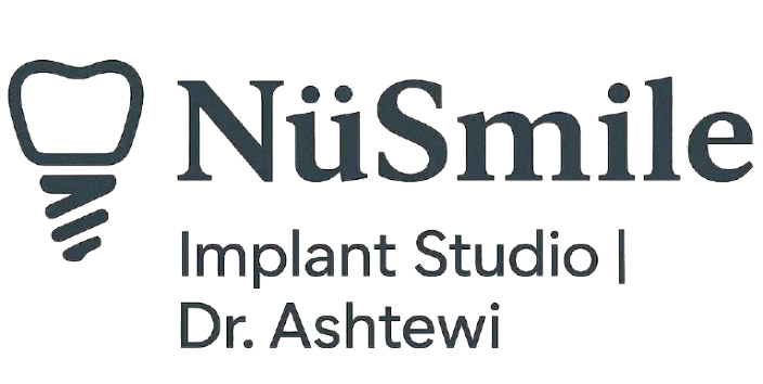 NuSmile Implant Studio logo featuring a tooth and dental implant, representing dental services focused on oral health and regular cleanings.