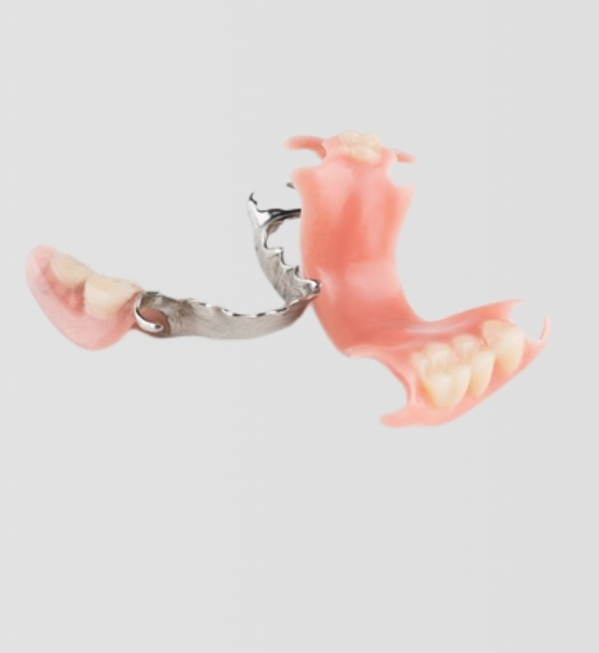 Partial dentures with pink acrylic base and metal clasp, designed to replace missing teeth and restore chewing ability, as featured at NuSmile Implant Studio.